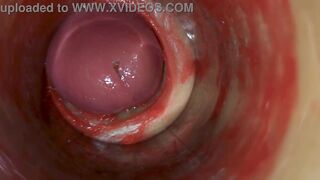 Camera Inside Deep Pussy Captures Huge Ejaculation of Sperm ASMR